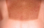 サンタン(suntan)